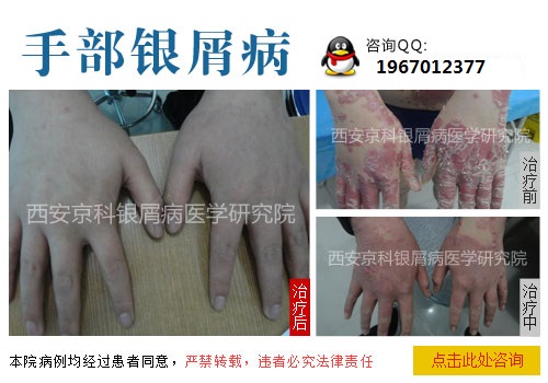 ��м���Ͻ��۵�˫�֣���ô��